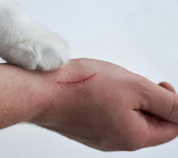 آیا چنگ زدن گربه نیاز به واکسن دارد